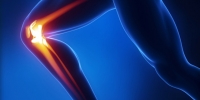 On peut soigner des ligaments du genou déchirés sans opérer